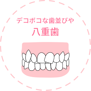 デコボコな歯並びや八重歯
