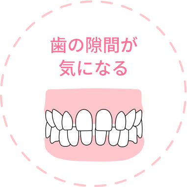 歯の隙間が気になる