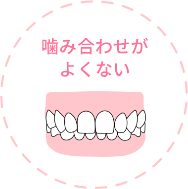 噛み合わせがよくない